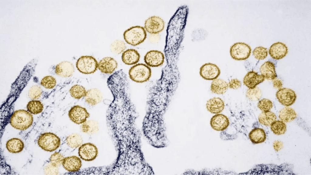 preocupa la propagación del Hantavirus en Argentina y el resto del mundo